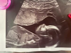 Ayla Brown's baby #2 ultrasound picture